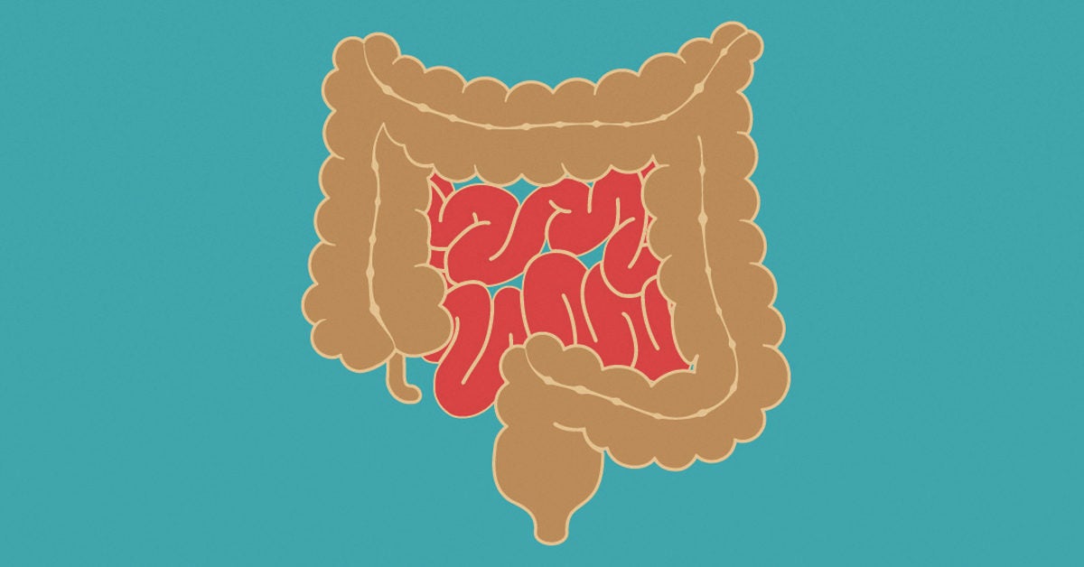 Small Intestine Cancer Symptoms Types And Treatment