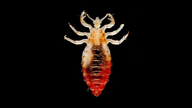 Body Lice Infestation: Causes, Symptoms & Diagnosis