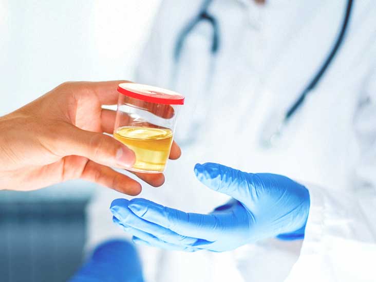 urine test for prostate cancer markers