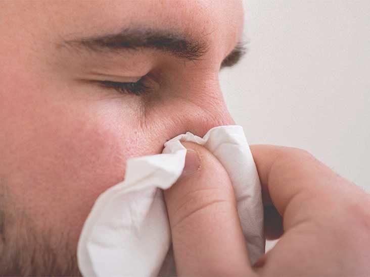 can nasal spray cause nose bleeds