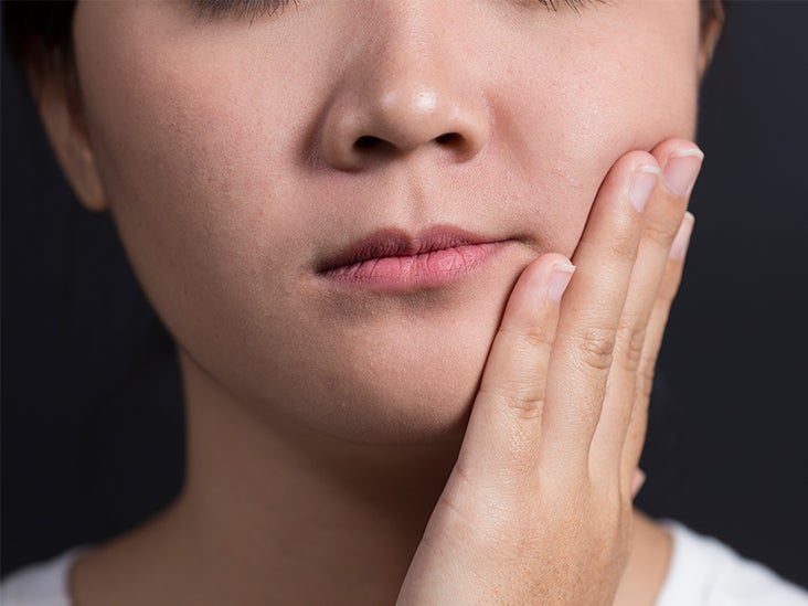 Cherubism Causes Symptoms And More