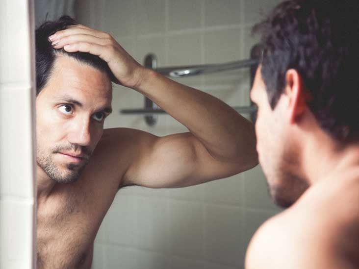 Receding Hairline: Stages, Causes, and Treatments