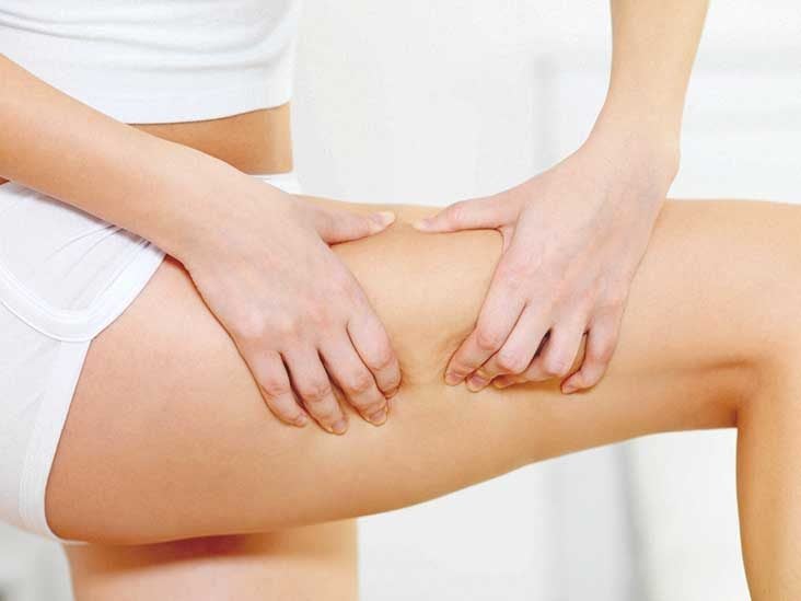 how to deal with cellulite in thighs