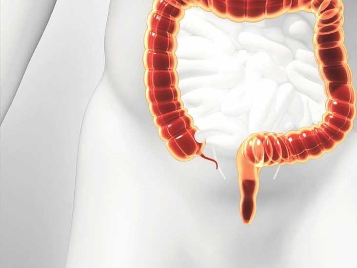 ruptured-appendix-what-it-feels-like-and-how-to-recognize-the-symptoms