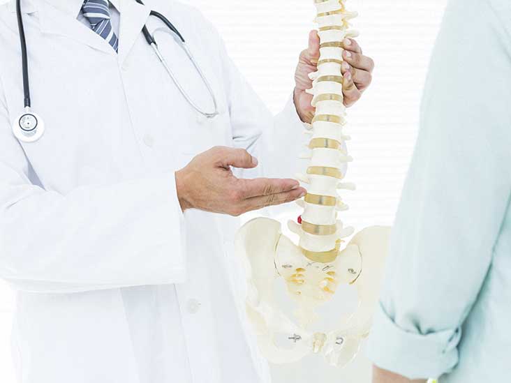 Levoscoliosis: Causes, Treatments, and More