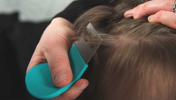 What Are Lice, and Where Do They Come From?