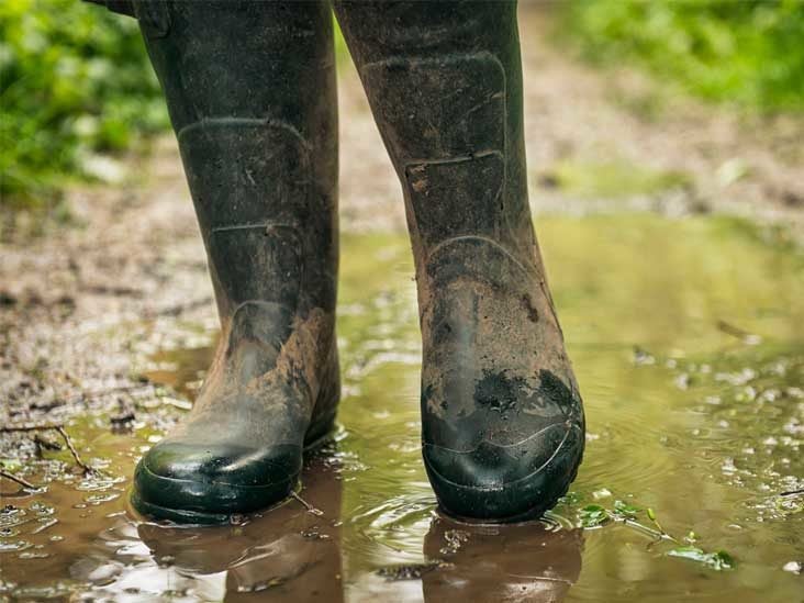 Trench Foot Symptoms Causes Pictures And Treatment