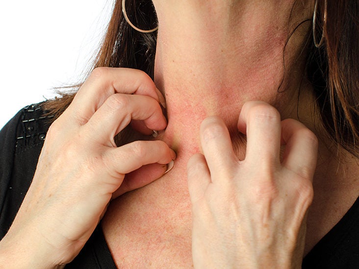 Itchy Mouth Causes Symptoms And Treatments