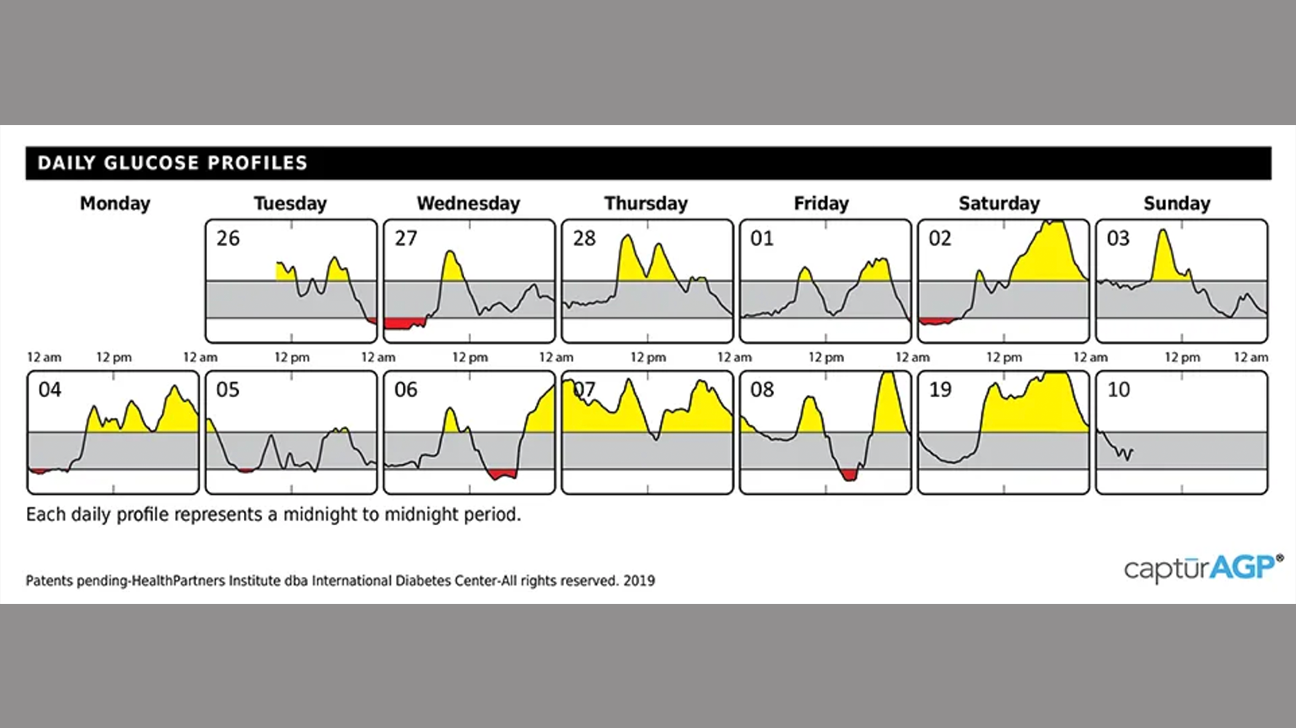 What is the Ambulatory Glucose Profile (AGP) for Diabetes?