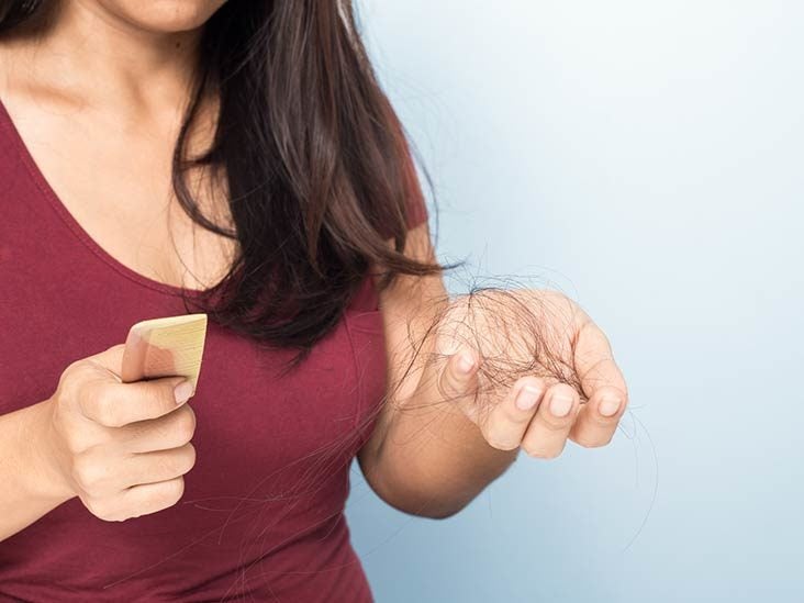 Hair Loss Treatments For Women