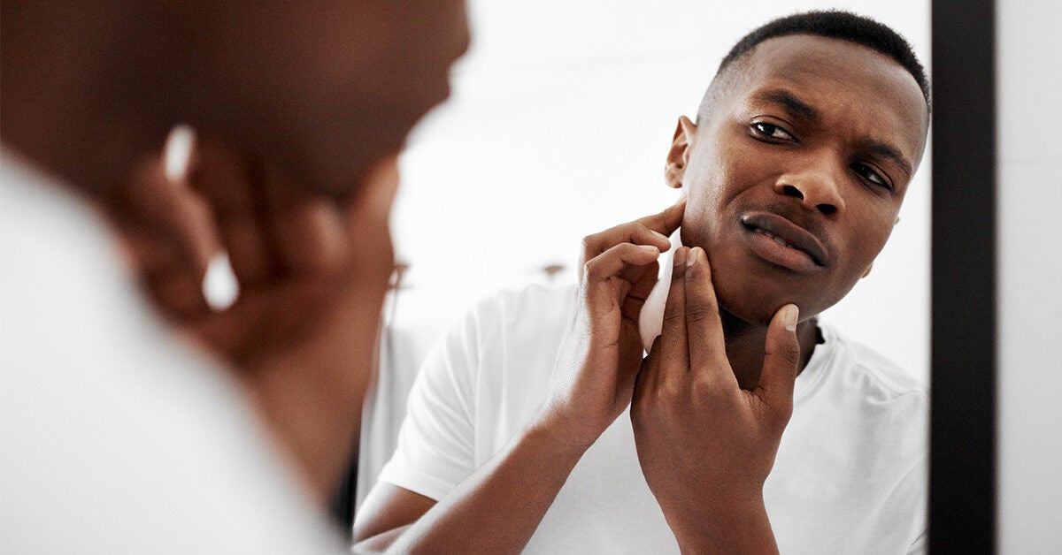 to Do Popping a Pimple: Treatment Alternatives to Popping