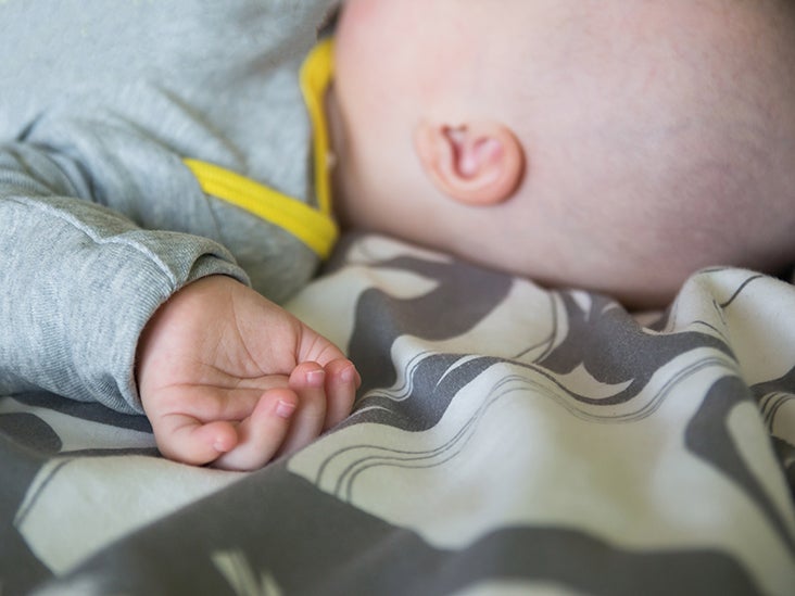 Megalencephaly Symptoms Treatment And Outlook