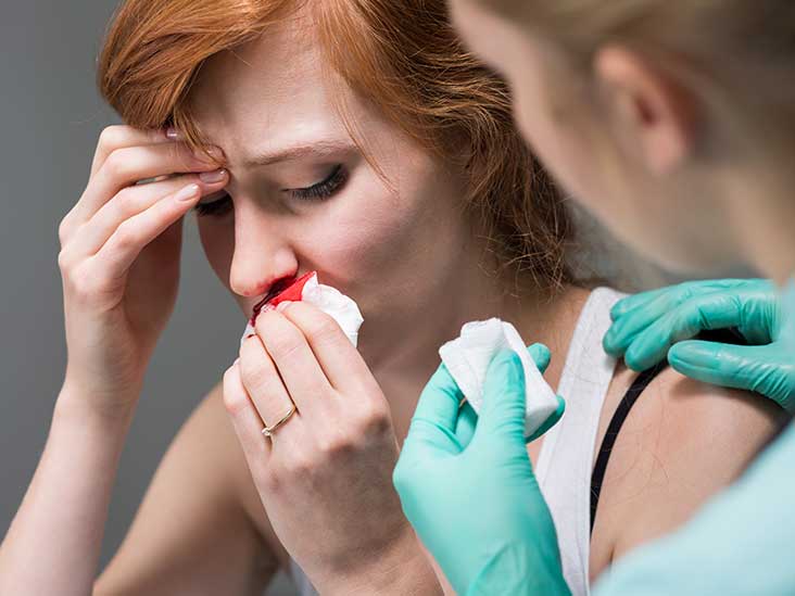 Osler-Weber-Rendu Disease: Causes, Symptoms & Diagnosis