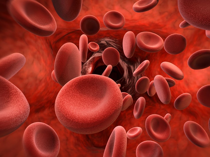 Acquired Platelet Function Disorder
