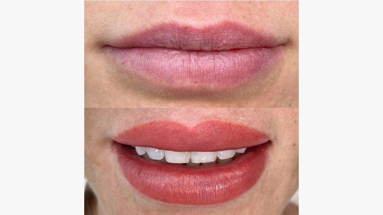 SemiPermanent Lips  things you need to know  Annette Kemp