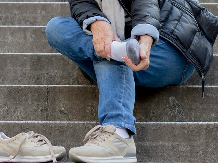 Intermittent Claudication Definition Symptoms Treatment And More