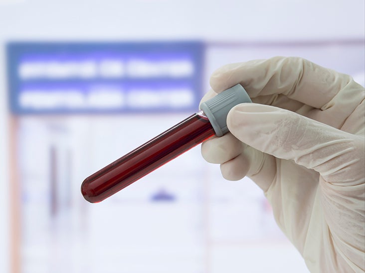 serum-hemoglobin-test-uses-procedures-and-risks