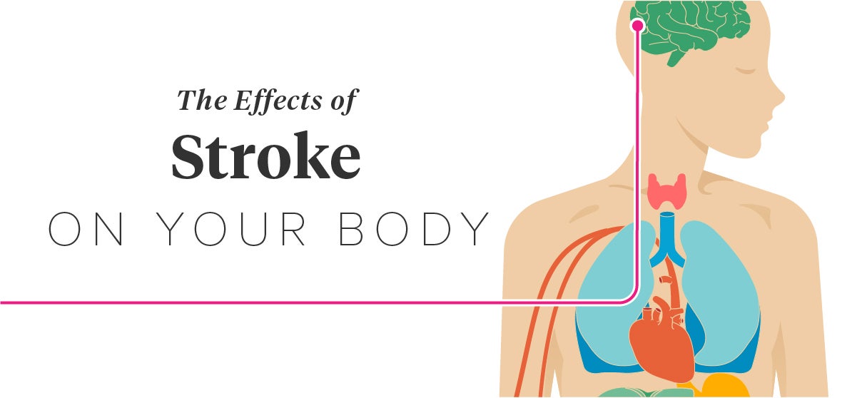 The Effects of Stroke on the Body