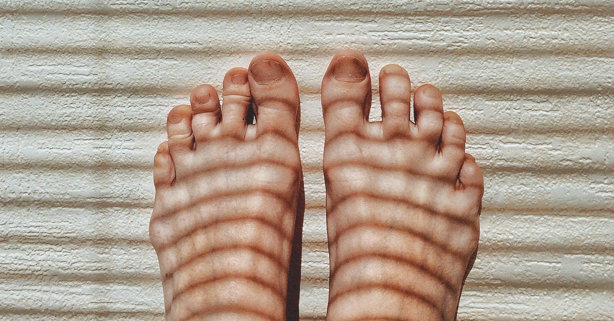 Red Toes Symptoms Causes And Treatments