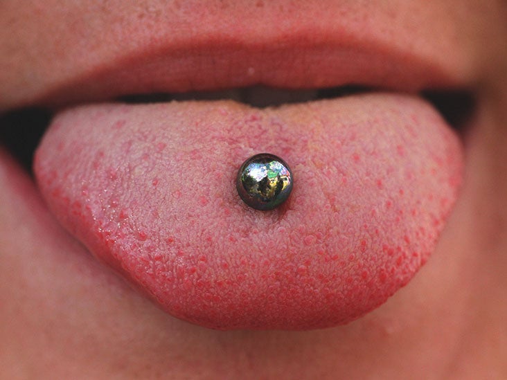 Tongue Piercing Infection: Symptoms 