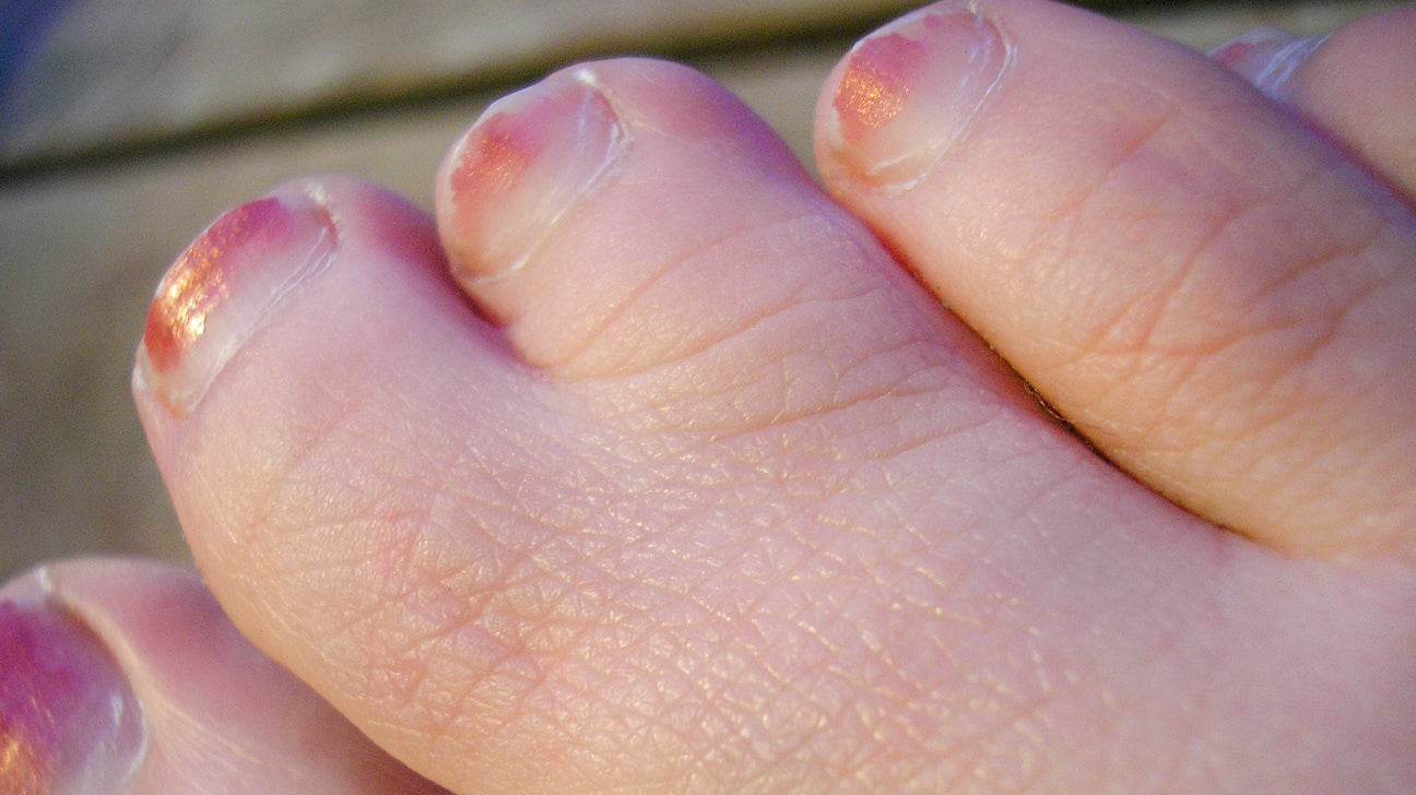 Webbed Hands
