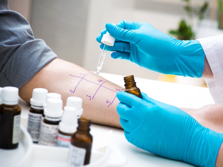 Allergy Testing Purpose Procedure And Results