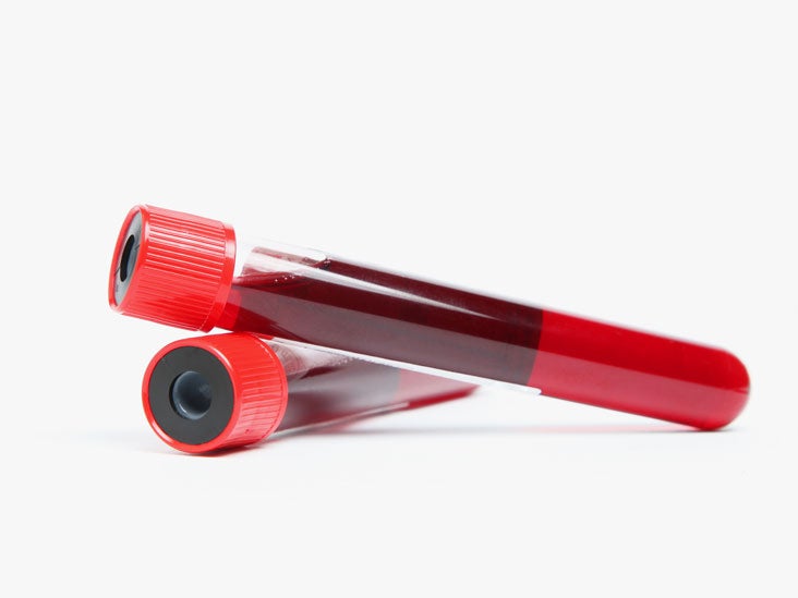 AntiSmooth Muscle Antibody Purpose, Risks, and Results