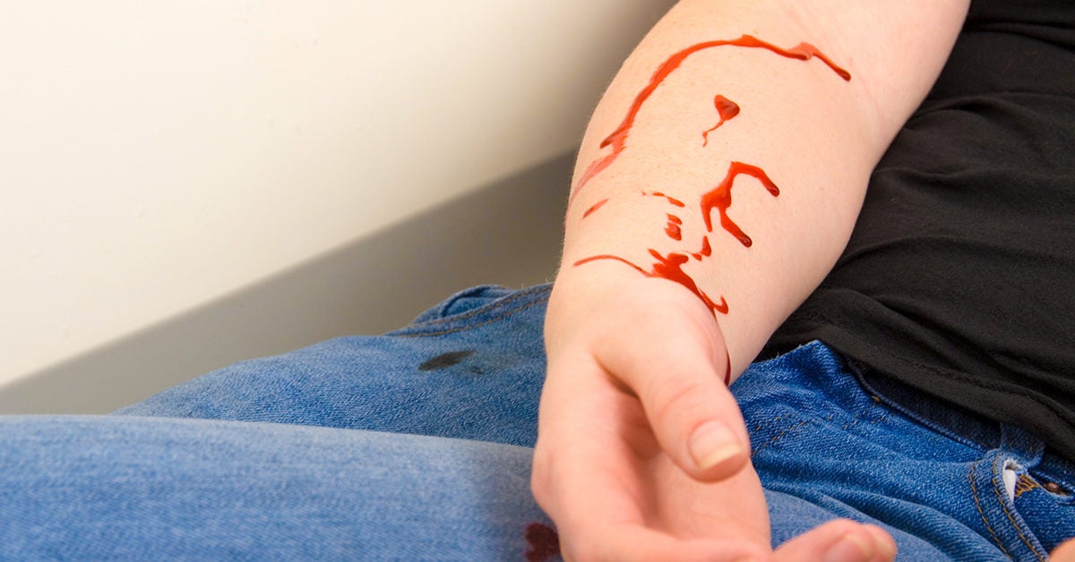 Bleeding to Death: Am I at Risk, and How Can I Stop It?