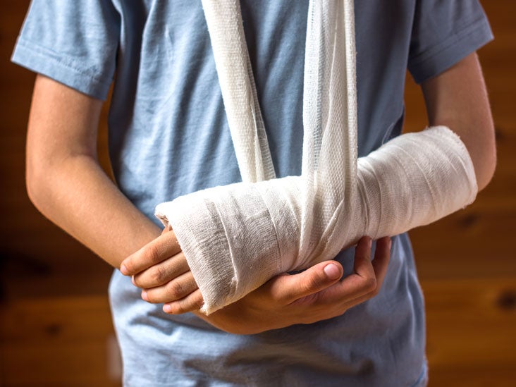 Bone Graft: Purpose, Procedure, and Risks