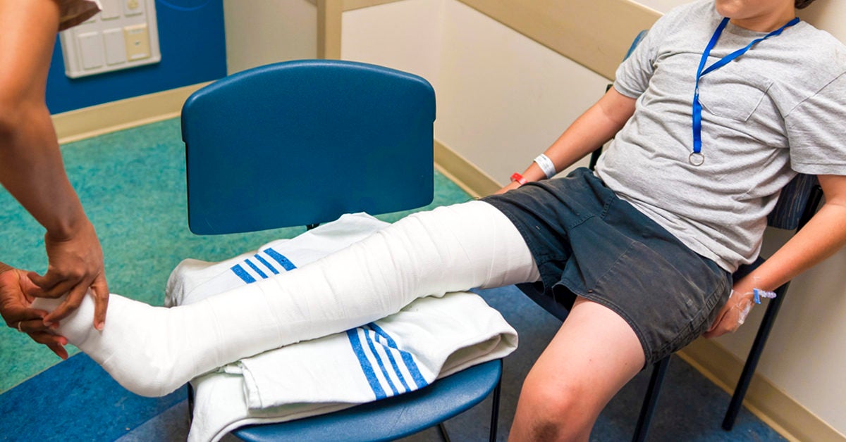 broken-femur-causes-treatment-and-complications