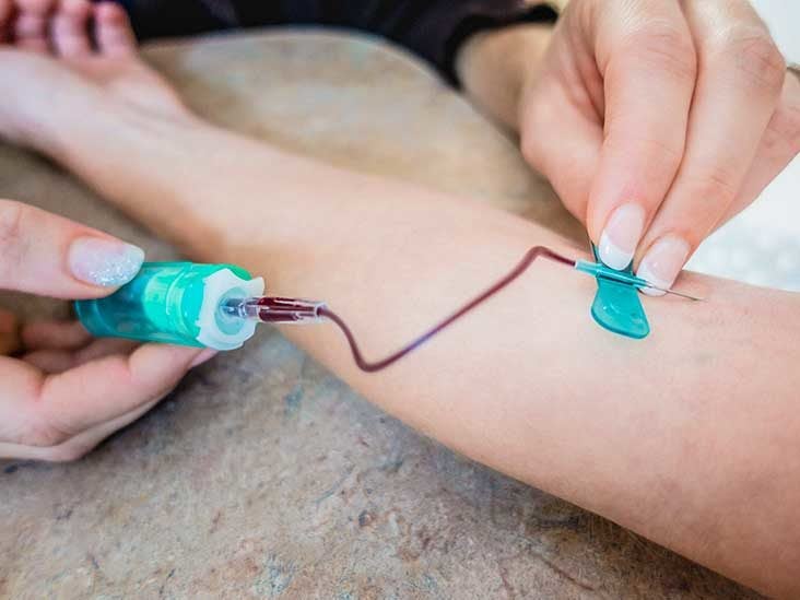 Butterfly Needle for Blood Draw: How It Works and Why It&#39;s Used