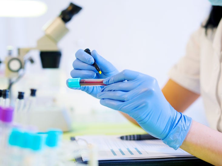 CO2 Blood Test Purpose Procedure And Results
