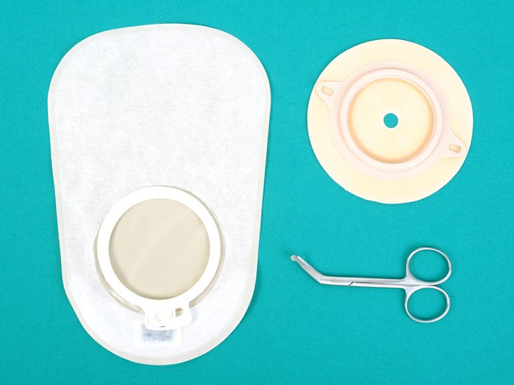 Colostomy Purpose, Risks, Procedure, FollowUp Care