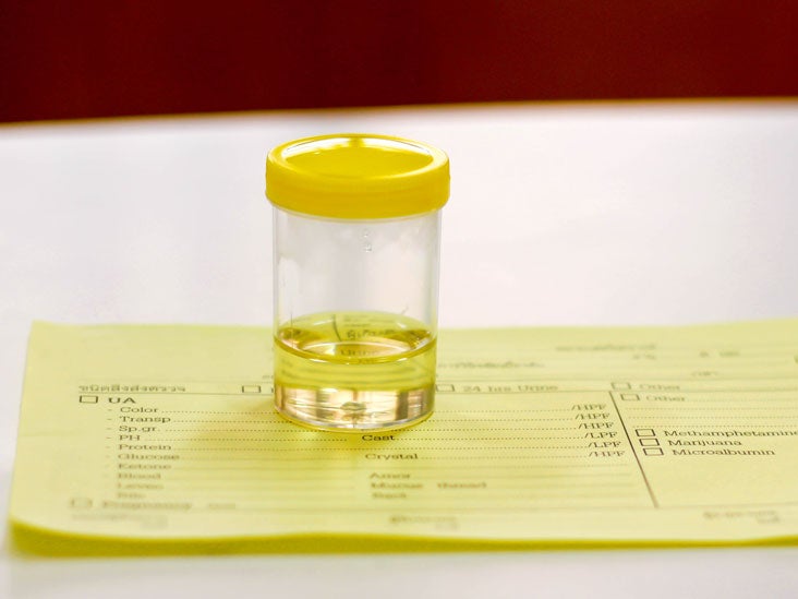 Cortisol Urine Test Purpose, Types, and Results