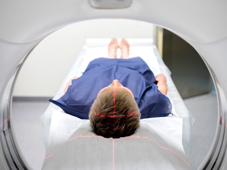 CT Scan (CAT Scan): Risks, and Results