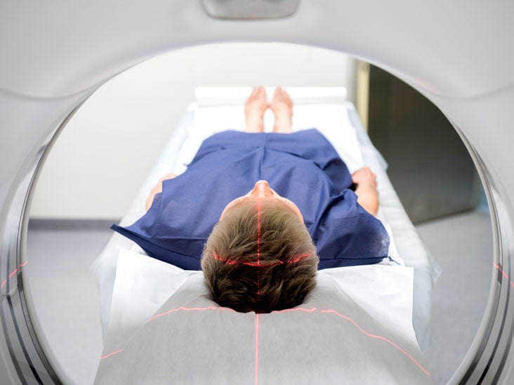 Cranial CT Scan: Purpose, Procedure, and Precautions