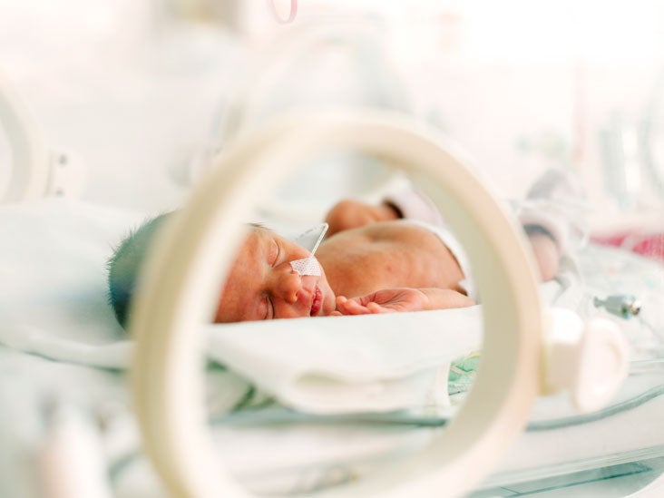 CriDuChat (Cat’s Cry) Syndrome Symptoms, Treatment & More