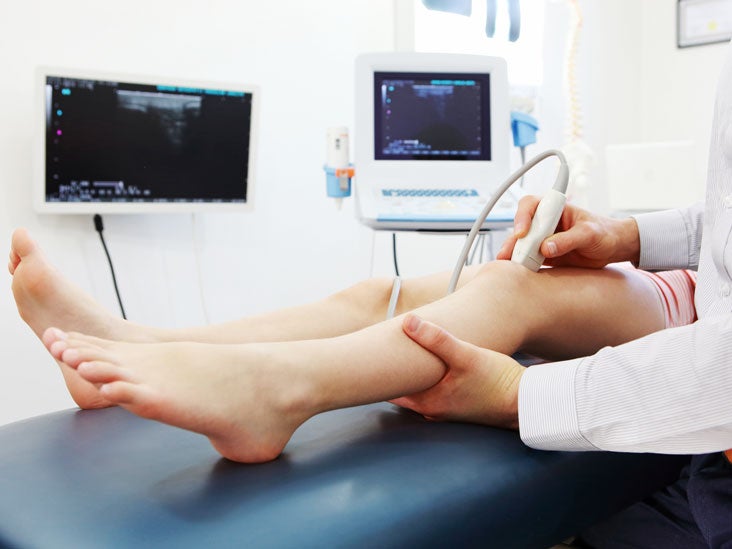 doppler-ultrasound-exam-of-arm-or-leg-purpose-results-and-more