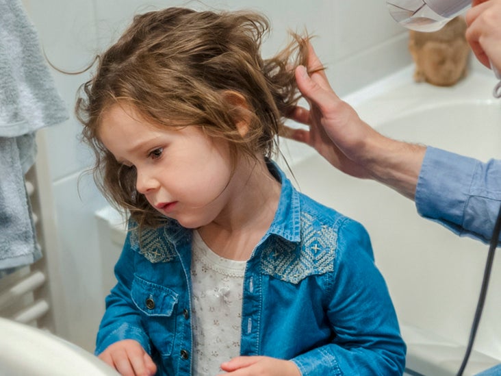 Hair Loss in Children: Causes and Treatments