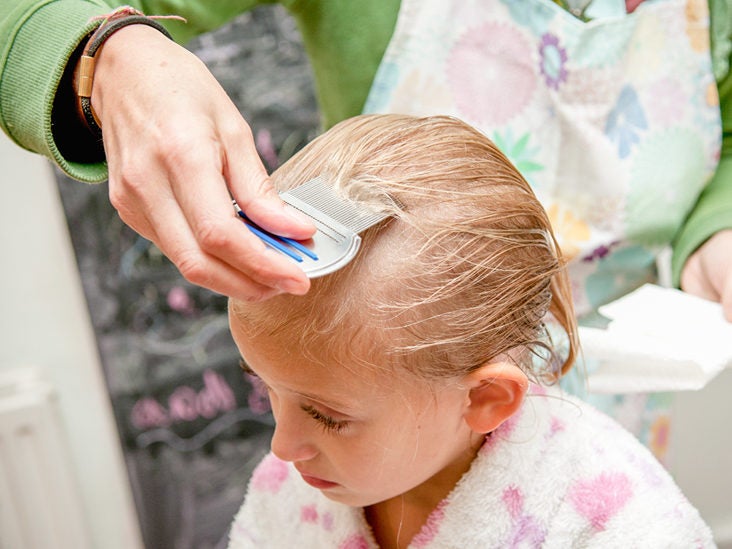 Head Lice Infestation: Causes, Symptoms & Diagnosis