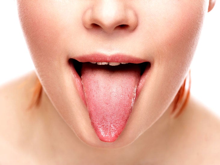 what causes burning tongue