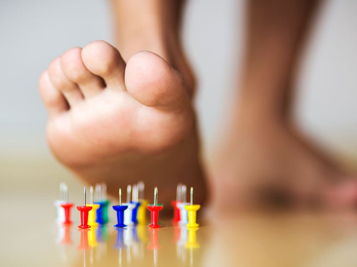 Idiopathic Neuropathy | Definition and Patient Education