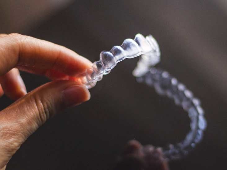 Invisalign Cost Alternatives And Comparison