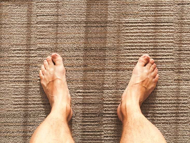 Toenails That Grow Upward: Causes and Home Treatments