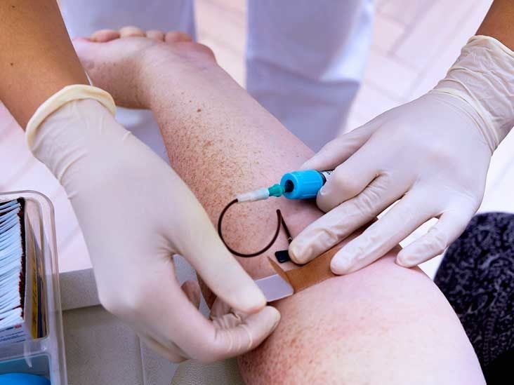 10 Important Blood Tests What They Show Why They Re Done More