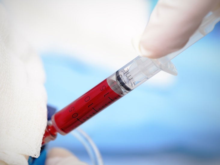 Methylmalonic Acid Test Purpose, Procedure, and Results