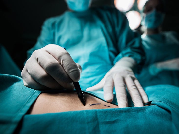 A Day in the Life of a Plastic Surgeon