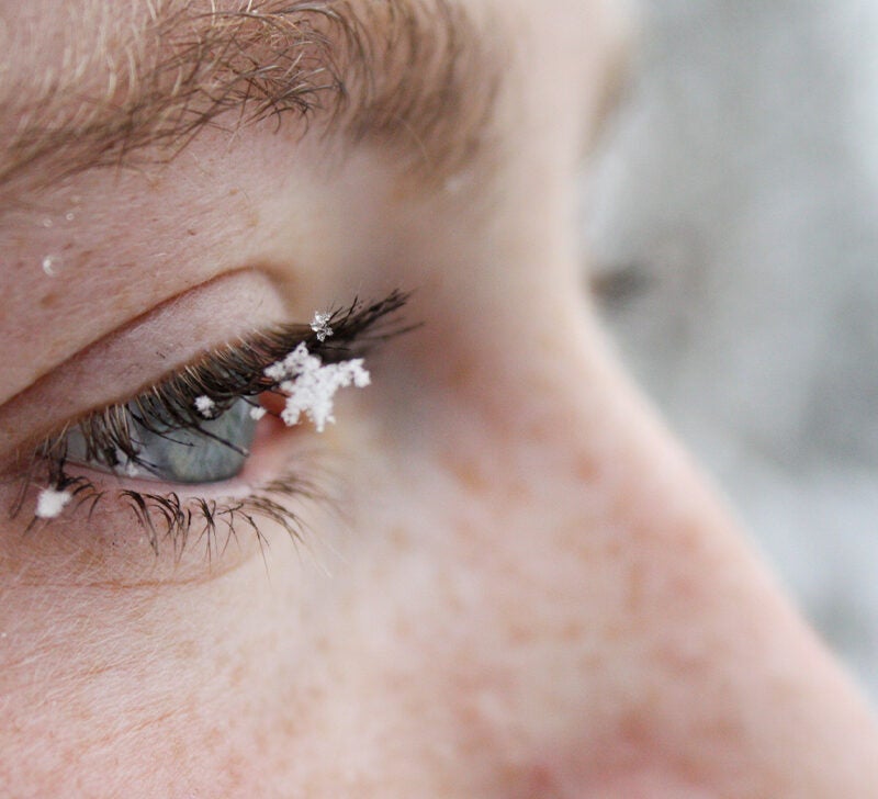 Dry Eyes In Winter Causes Treatment And Prevention