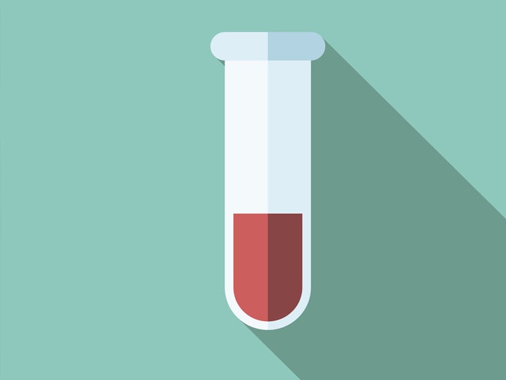 kwaadheid de vrije loop geven Respect Dominant Blood Sodium Level Test: Purpose, Procedure, and Results