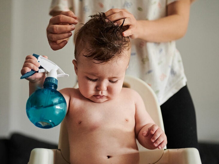 Baby Hair Loss: Why Is My Infant's Hair Falling Out?